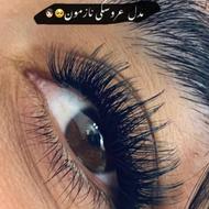 هنرجو کاشت هیدن می‌پذیرم