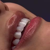 دندانپزشکی اقساط به مدت محدود