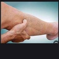 انواع رگ گیری و ماساژ درمانی