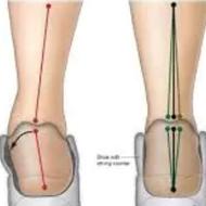 کلینیک تخصصی درمان کلیه مشکلات راه رفتن