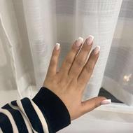 مدل برای ترمیم