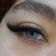 کاشت مژه هیدن