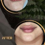 خدمات ژل و بوتاکس