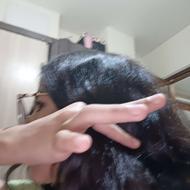 موی میدم 14میلون که شپش نداره کلفته وفره