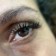 کاشت هیدن و لیفت ابرو به سبک روسی