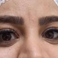 مدل برای کاشت مژه