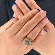 کاشت ناخن و ترمیم