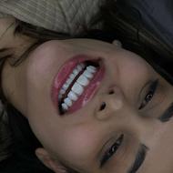 کامپوزیت دندان