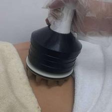 لاغری موضعی با دستگاه جی فایو و کمربندهای حرارتی ترمودرمی