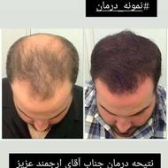 قطع ریزش و رویش مجدد با ما با بیش از رضایت 1000بهبود جو