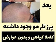 درمان مشکلات ریزش مو و پوستی در شیپور