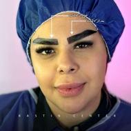 تخفیف ویژه « کاشت ابرو و مو ، جراحی پلک »