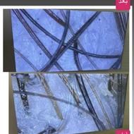 خدمات تخصصی اسکراپ واسکالپ با قیمت اقتصادی