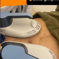 لاغری دستگاه EMS