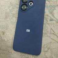 شیائومی ردمی 13