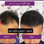 کلینیک تخصصی کاشت مو