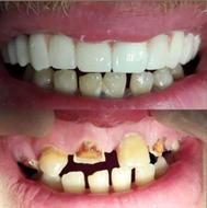 خدمات لابراتوار دندان