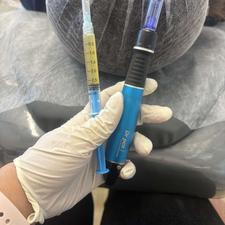 تزریق ژل و بوتاکس و پاکسازی