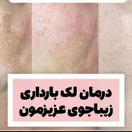 کرم ضد لک لاکچری کوین ، درمان همه نوع لک پوستی