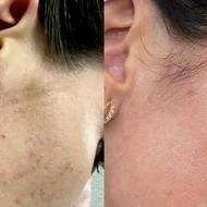 درمان مشکل پوستی