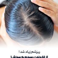 درمان قطعی ریزش و رشد مو برای اولین بار در مازندران بابل