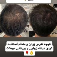 پک درمانی مو