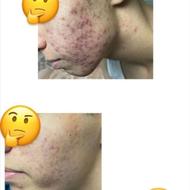 درمان قطعی انواع مشکلات پوستی