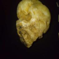 سنگ قیمتی کامل شبیه اسکلت سر انسان.