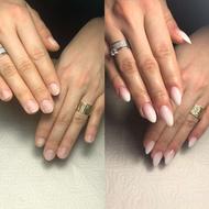 کاشت ناخن دست و پا