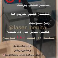 دستگاه لاغری