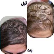 پک تقویتی مو وپرپشتی مو