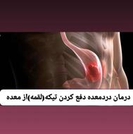 تیکه چی معده درمان مشکلات گوارش اردبیل