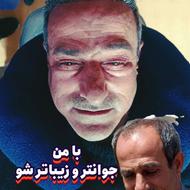 زیبایی و کاشت مو