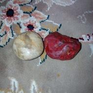 سنگ گلبولی و عقیق