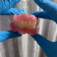 دست دندان متحرک با کیفیت عالی و برند ترین دندان باقیمت مناسب