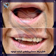 دندانپزشکی اقساطی