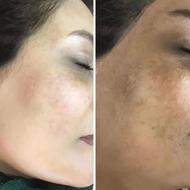 کارشناس تخصصی پوست و مو