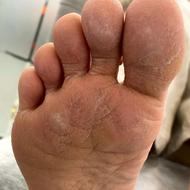 پدیکور درمانی به روش روسی