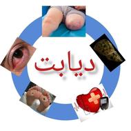 درمان دیابت بدون انسولین