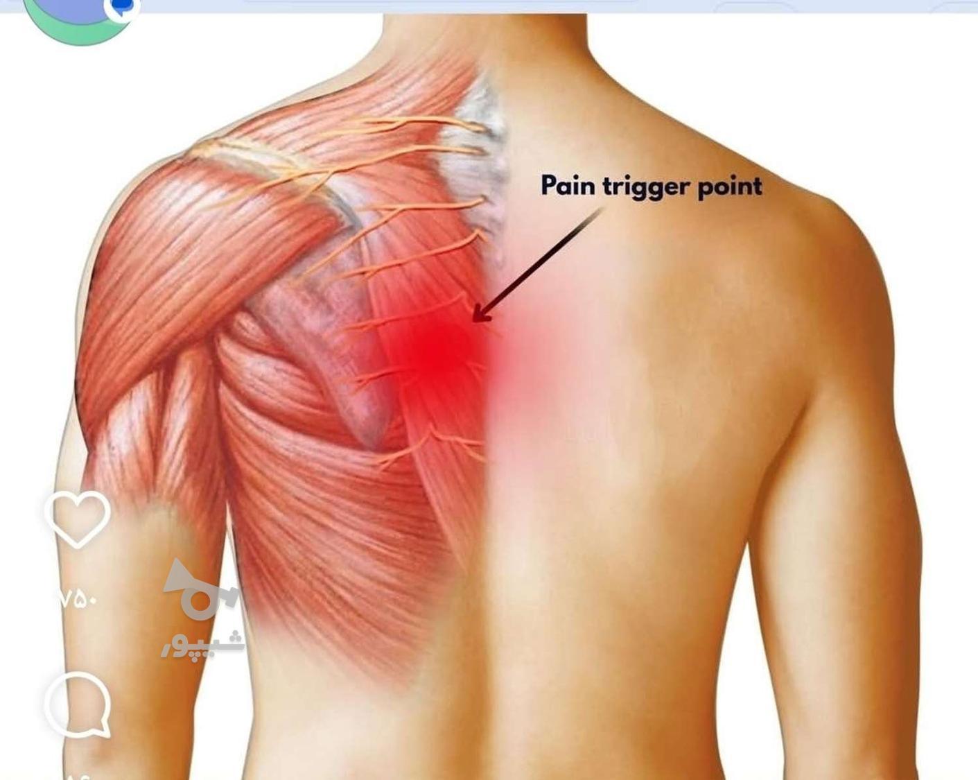 ماساژدرمانی