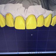 طراح اگزوکد مسلط به فول اناتومی وطرح لبخند