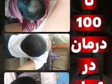 پک فرانسوی ضد ریزش مو در شیپور