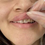 پیرسینگ و میکرودرمال