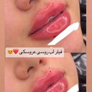 ژل و بوتاکس اقتصادی