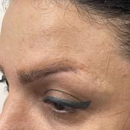 کاشت مو و ابرو و ریش طبیعی تخصص ماست