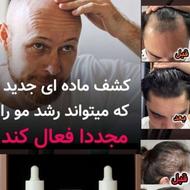 رویش مجدد مو