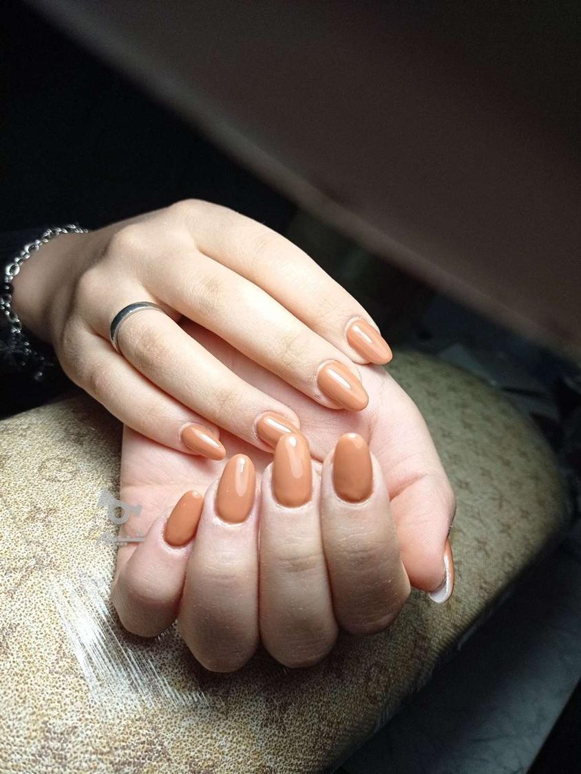 کاشت و ترمیم ناخن