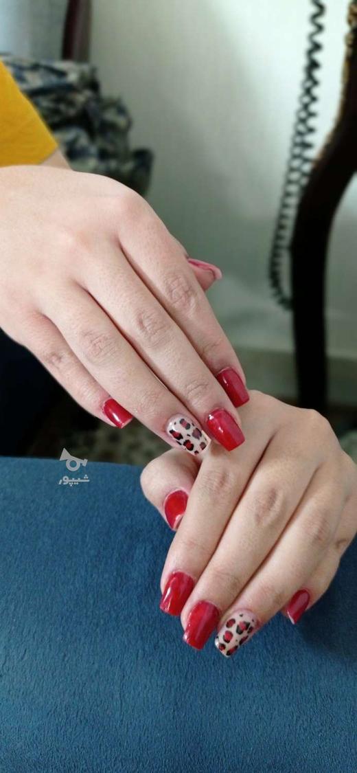 کاشت و ترمیم ناخن