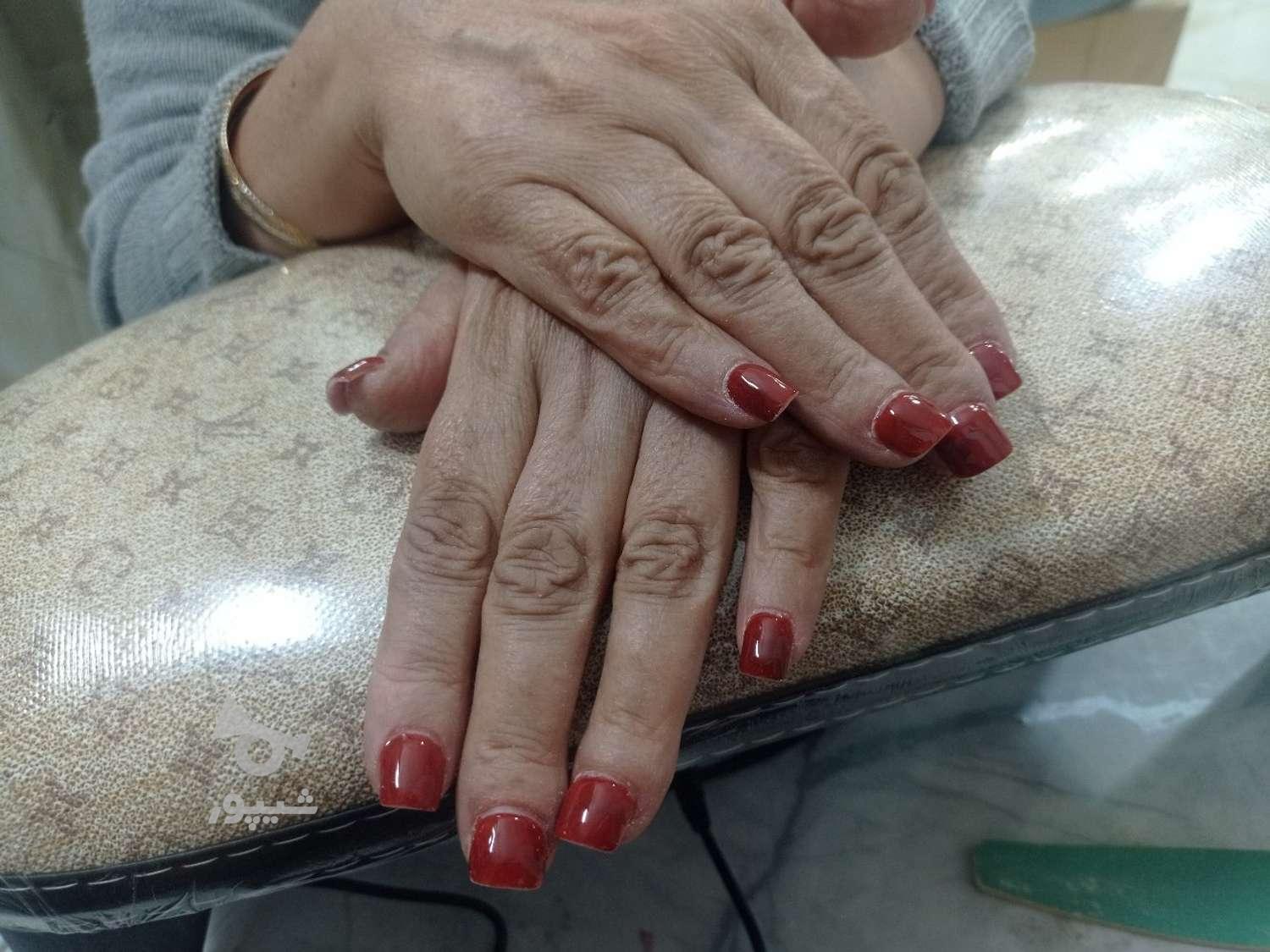 کاشت و ترمیم ناخن