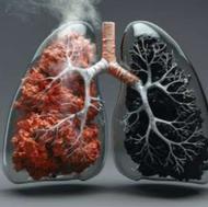 مشاوره رایگان درمان اعتیاد